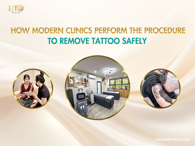 Laser tattoo removal procedure using modern technology in Rio Beauty Spa's professional clinic environment.