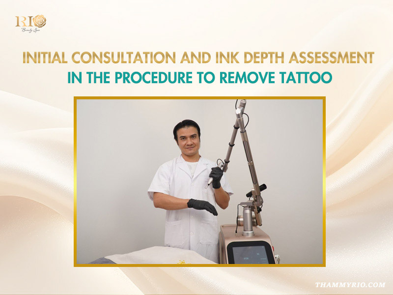 Expert technician preparing a laser device for the initial consultation and ink depth assessment in the procedure to remove tattoo.
