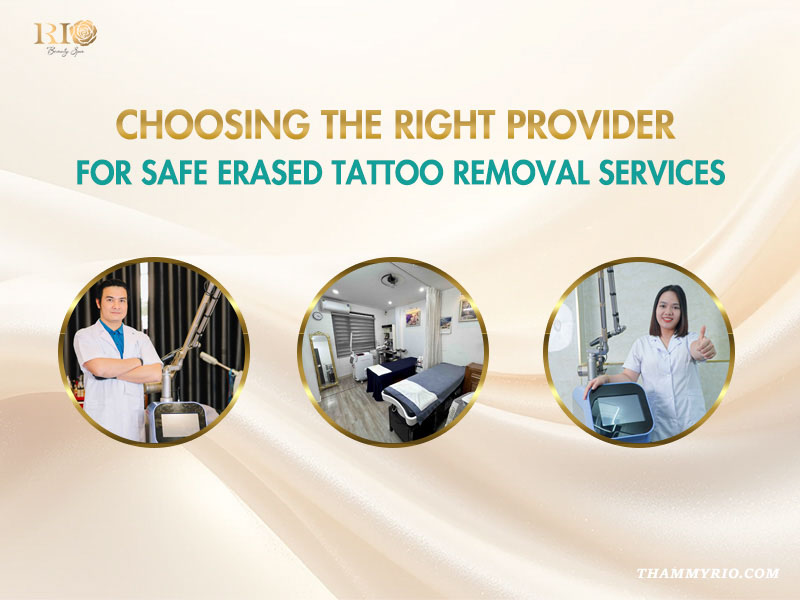 Professional staff and modern clinical facility at Rio Beauty Spa for a safe procedure to remove tattoo.