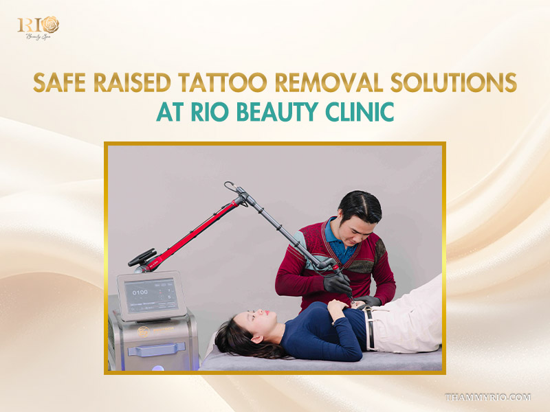 A specialist performing laser treatment for raised tattoo removal on a client at Rio Beauty Clinic.