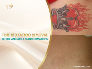 A close-up comparison of red tattoo removal before and after treatment, showing successful ink clearance on the skin.