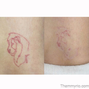 Red tattoo removal before and after results for a dog head outline. Ink faded to faint outlines.