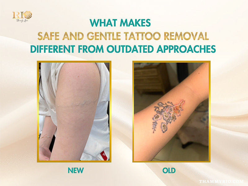 Comparison between safe and gentle tattoo removal results and outdated, harmful methods.