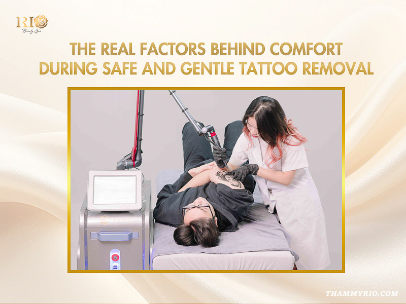 Professional technician performing safe and gentle tattoo removal with advanced laser technology.