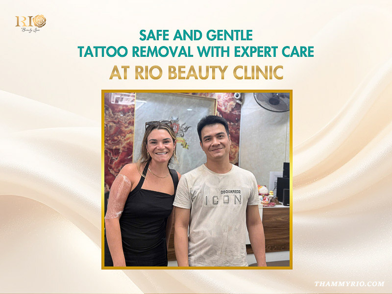 A client receiving safe and gentle tattoo removal at Rio Beauty Clinic with expert professional care.