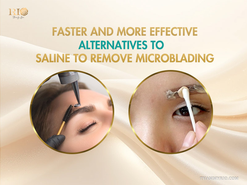 Faster and more effective alternatives to saline to remove microblading featuring laser and chemical methods.