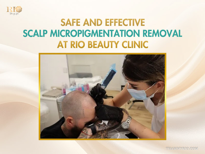 Safe and effective scalp micropigmentation removal treatment for a male client.