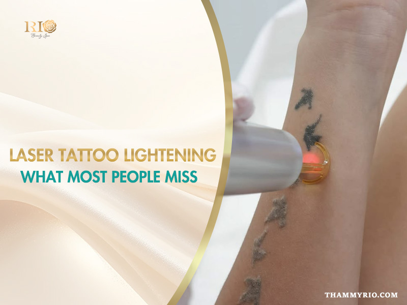 Professional laser tattoo lightening process on a forearm.