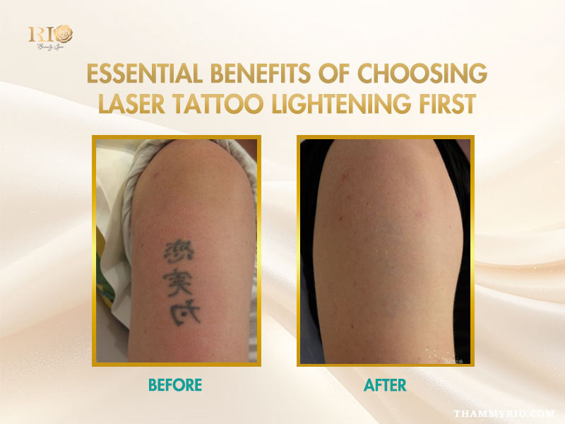 Before and after comparison of laser tattoo lightening on a black ink arm tattoo.