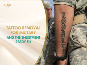 Forearm of a soldier in a camouflage uniform with a "LOYALTY" tattoo, displayed alongside text promoting tattoo removal for military enlistment.