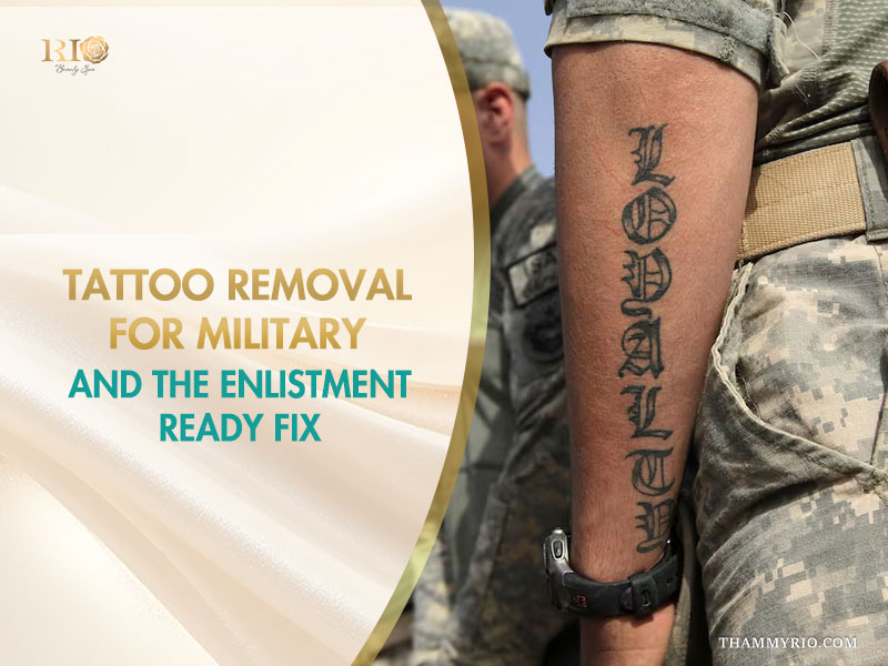 Forearm of a soldier in a camouflage uniform with a "LOYALTY" tattoo, displayed alongside text promoting tattoo removal for military enlistment.