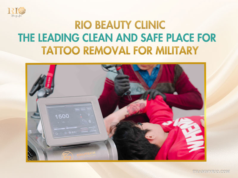 Professional tattoo removal for military personnel at Rio Beauty Clinic using advanced laser technology.