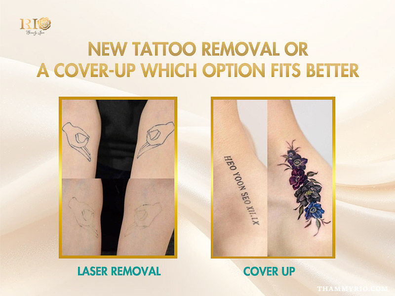 Comparison between a tattoo removal for new tattoo using laser and a tattoo cover up with floral design.