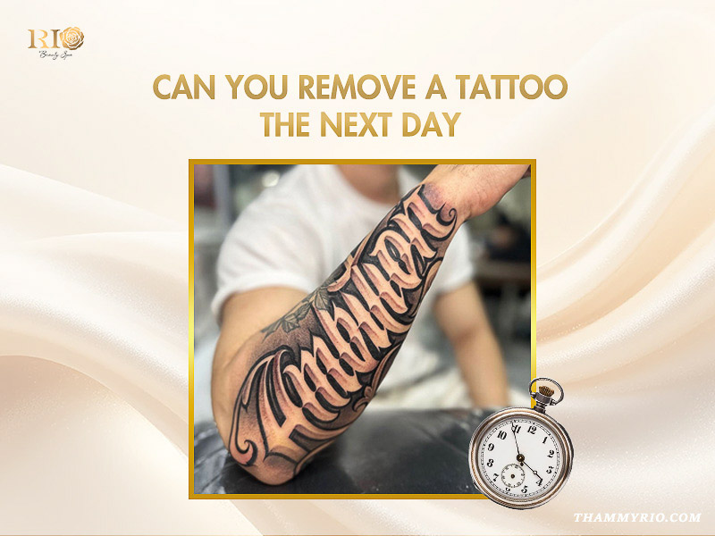 Large calligraphy forearm tattoo shown next to a pocket watch illustrating a tattoo removal for new tattoo timeline question.