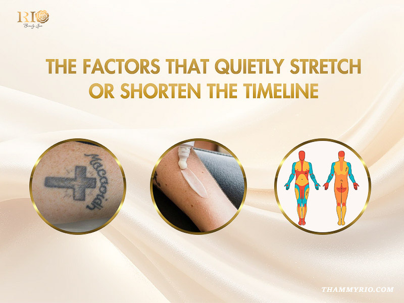 Factors influencing tattoo removal over time including tattoo type aftercare and body placement locations.