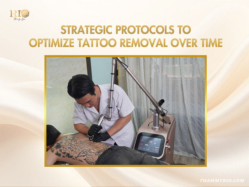 Specialist using an advanced laser machine on a large back tattoo for professional tattoo removal over time.
