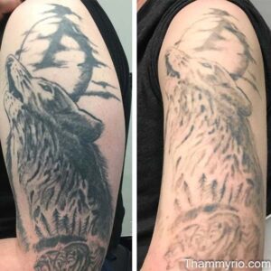 Comparison of tattoo removal second session progress on a wolf shoulder tattoo.
