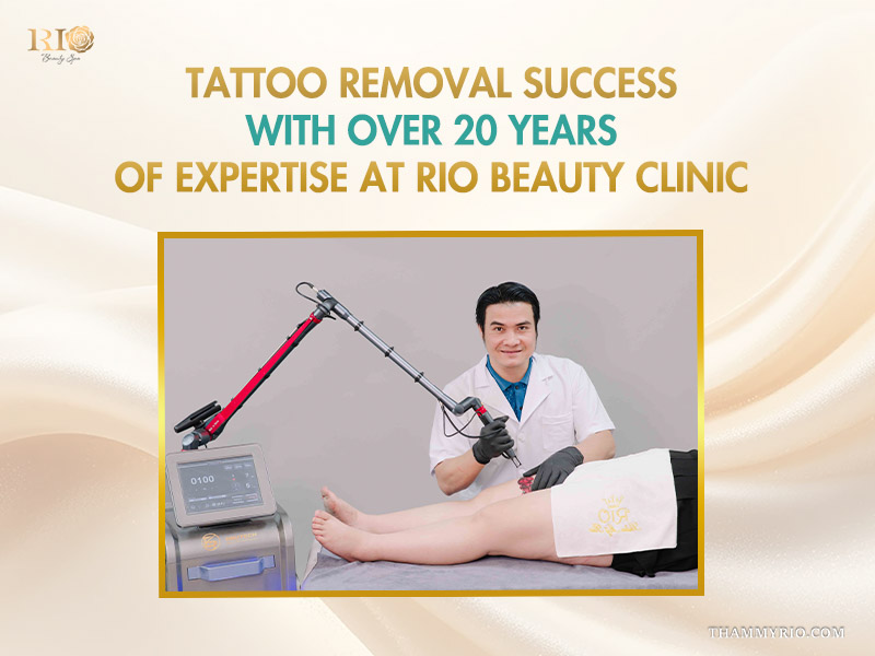 Tattoo removal success with over 20 years of expertise at Rio Beauty Clinic featuring a professional laser treatment session.