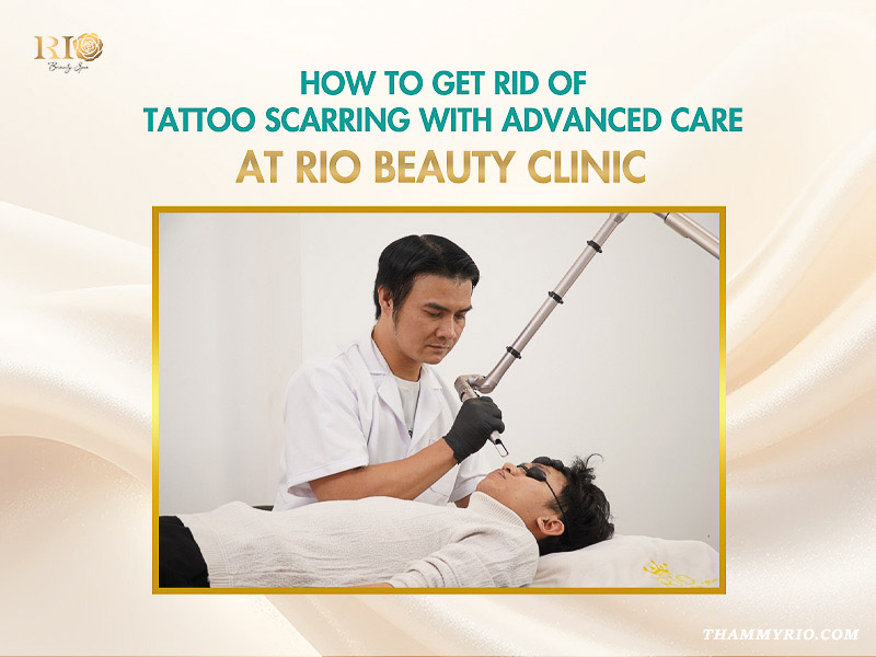 A male dermatologist or laser specialist at Rio Beauty Clinic, wearing a white coat and black gloves, uses a precision laser handpiece to treat a male patient's facial skin.