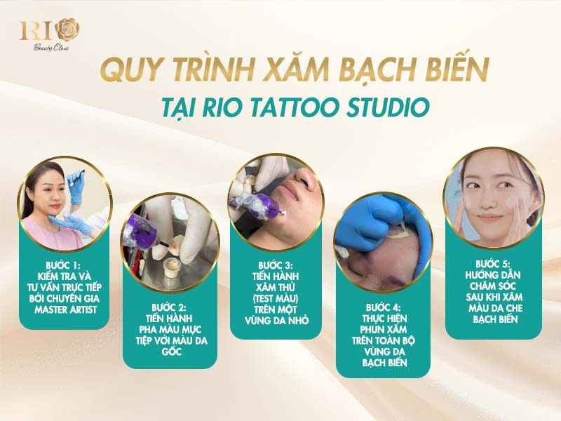 Quy trình thực hiện xăm màu da che bạch biến chuẩn y khoa, an toàn tại Rio Beauty Clinic.