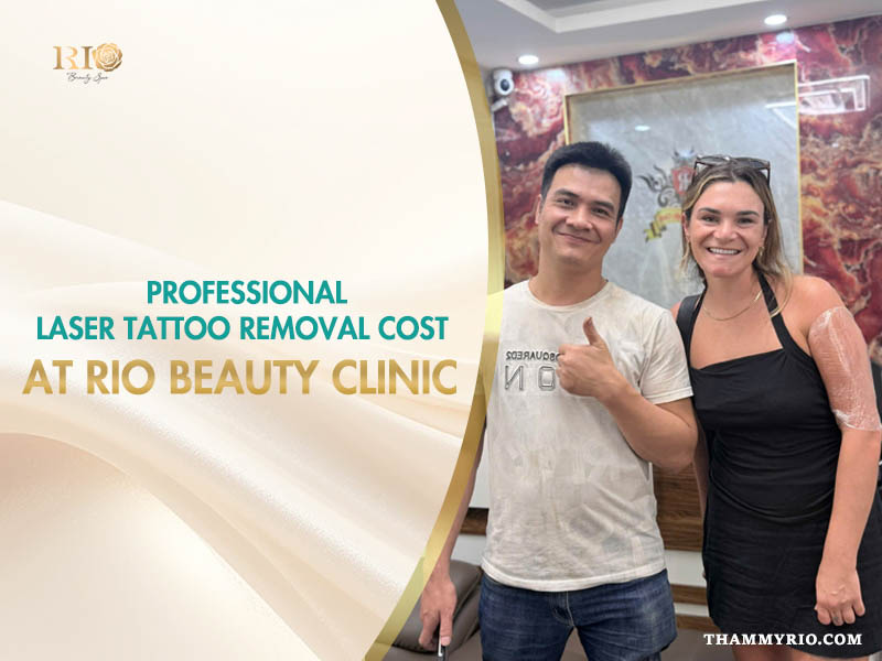 Professional laser tattoo removal cost analysis