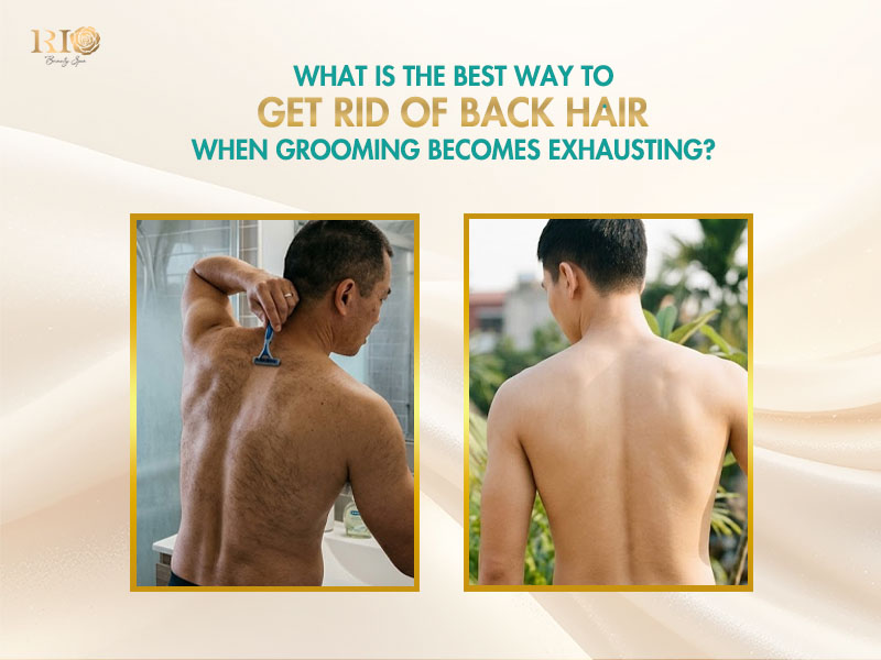 Infographic comparing a man struggling with a razor versus a smooth back after professional back hair removal.