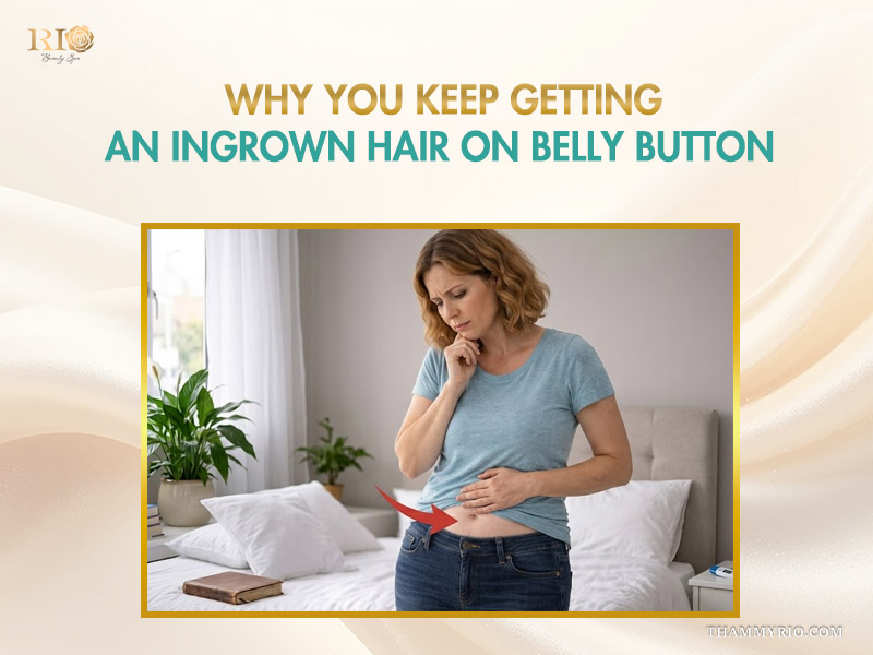 An educational banner from Rio Beauty Spa with text reading why you keep getting an ingrown hair on belly button.