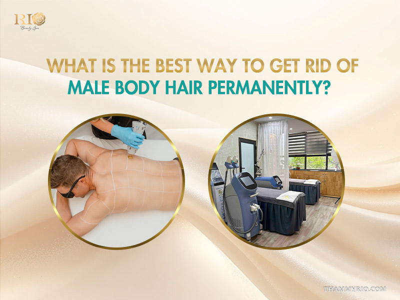 Advanced laser body hair removal for men providing a permanent and effective solution to get rid of hair.