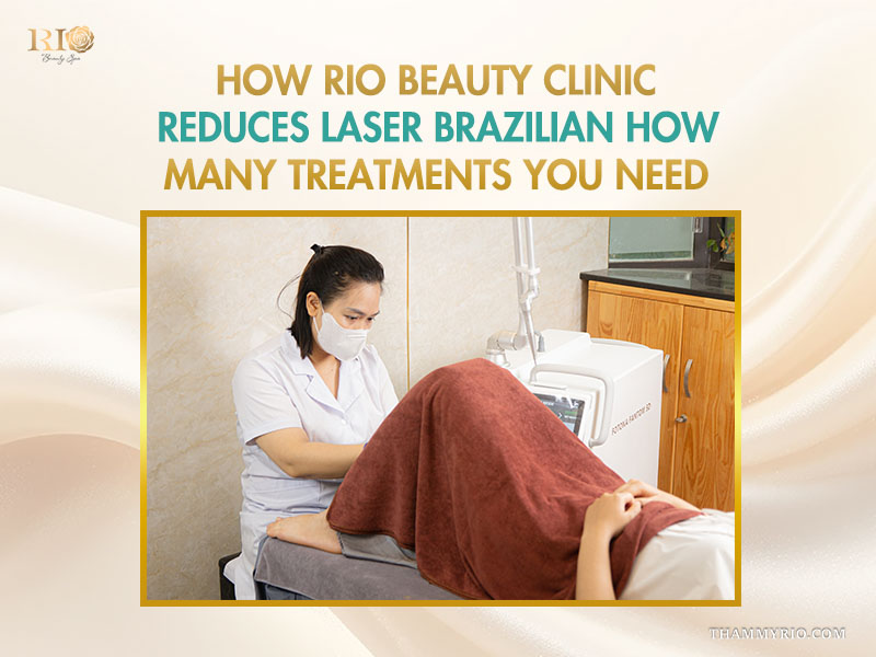 A technician performing a laser procedure to optimize a client plan for brazilian laser hair removal how many sessions at Rio Beauty Clinic.