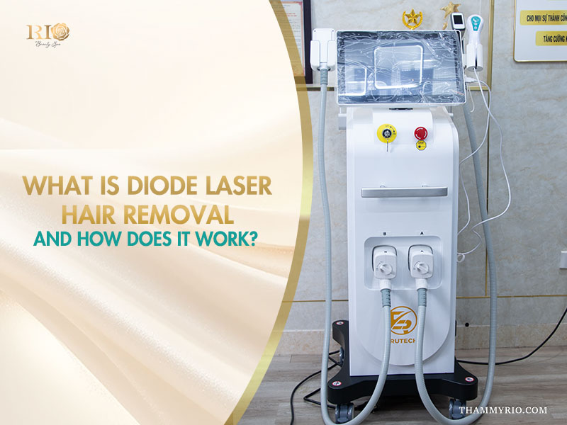 An illustration of how Diode Laser Hair Removal technology works by targeting hair follicles under the skin.