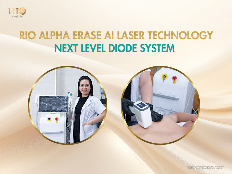 Professional technicians standing by advanced machines for Diode Laser Hair Removal services at Rio.