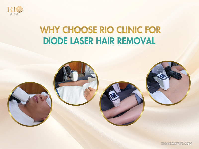 A four-image grid showcasing real smooth skin results across different body areas after Diode Laser Hair Removal.