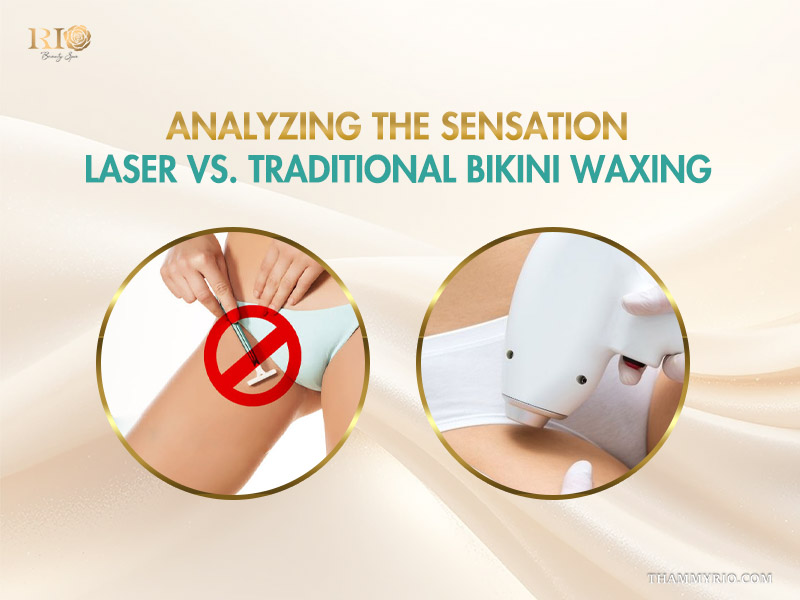 Comparison between traditional bikini waxing and professional laser hair removal to answer does brazilian laser hair removal hurt.