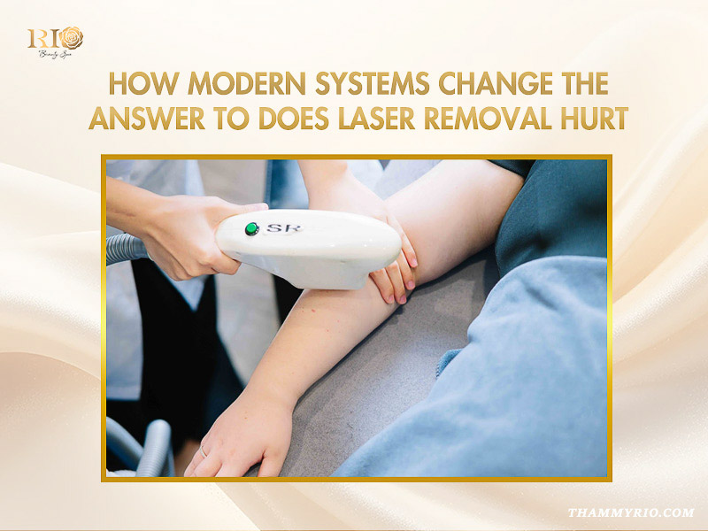 Rio Beauty Spa procedure uses a modern SR system to address does laser hair removal hurt. Technicians treat a client’s arm.