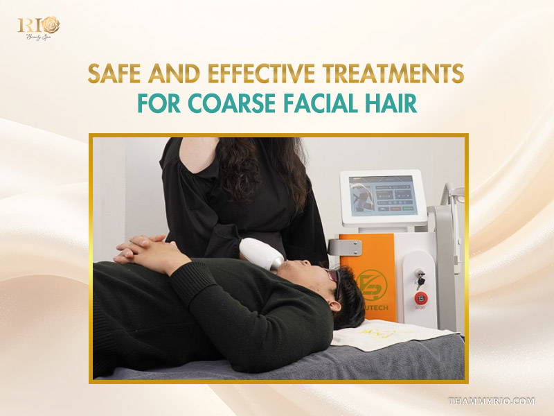 Professional laser treatment for reducing thick and coarse facial hair in female patients at a beauty spa.