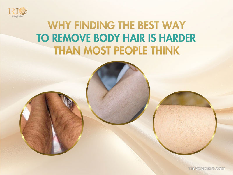 Three people with thick, thin, and normal hair types comparing the costs of the best way to remove body hair.
