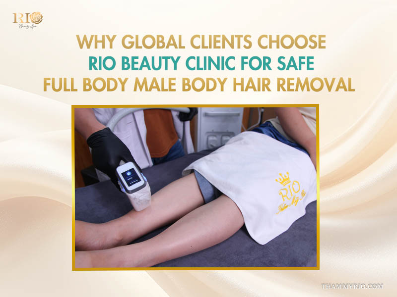 Safe full body male body hair removal service at Rio Beauty Clinic for international clients