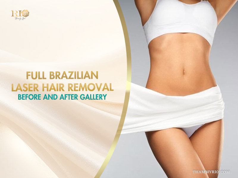 A woman curiously checking her smooth skin, featured in full brazilian laser hair removal before and after photos.