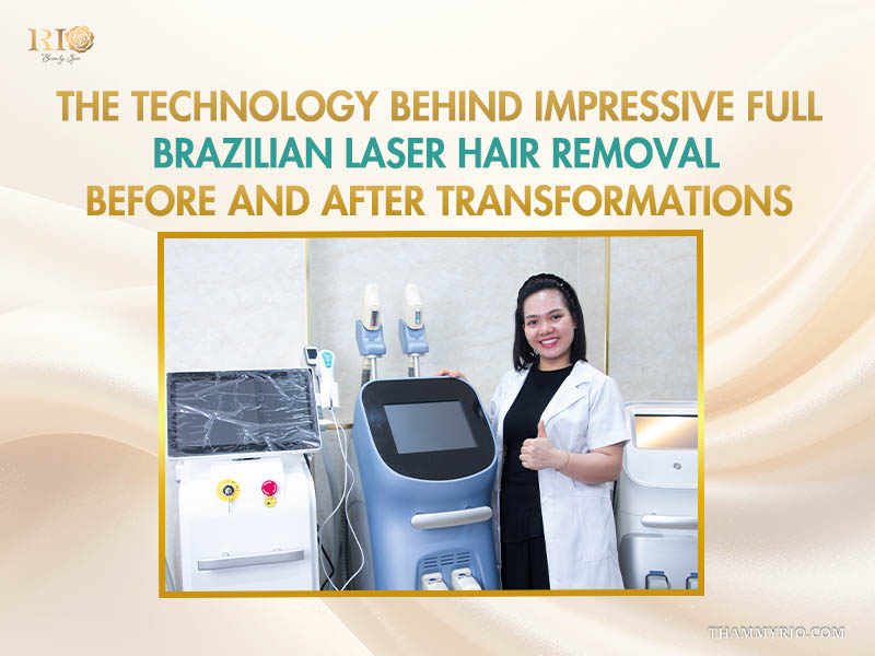 Rio Alpha Erase AI Laser device creating amazing full brazilian laser hair removal before and after photos.