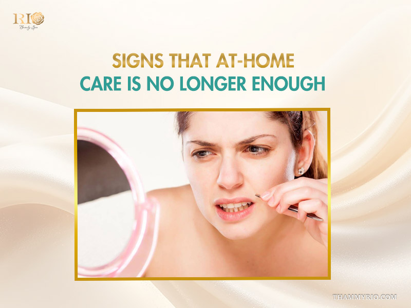 A frustrated woman using tweezers in front of a mirror, showing when trying to get rid of facial hair at home is no longer enough.