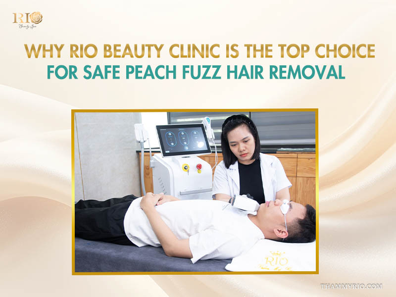 Expert laser service for getting rid of peach fuzz at Rio Beauty Clinic.