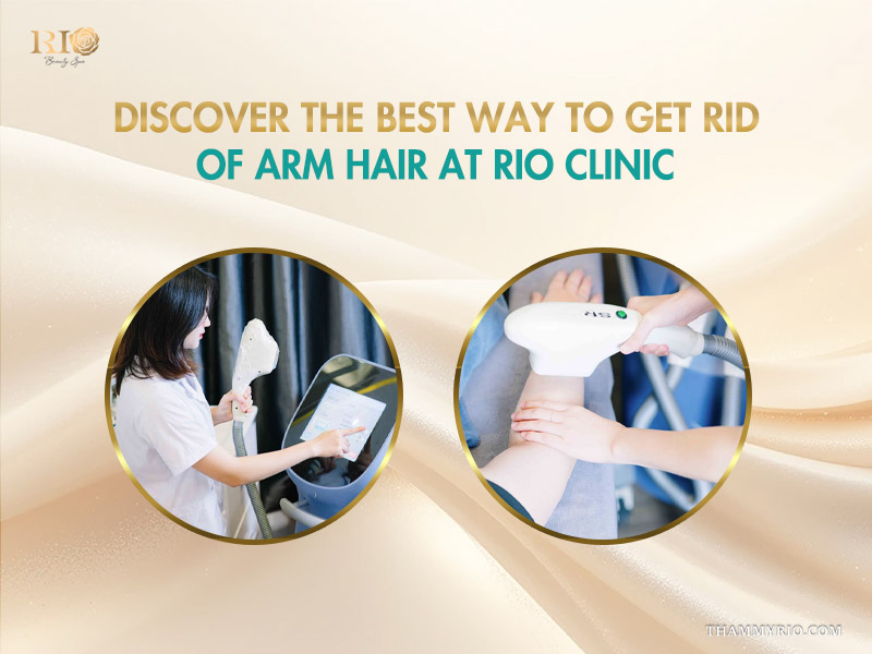 Professional laser hair removal for arms service using advanced technology at Rio Clinic.