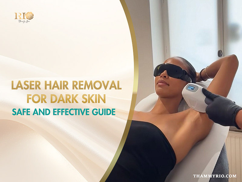 Laser hair removal for dark skin treatment on a female client at Rio Beauty Clinic.