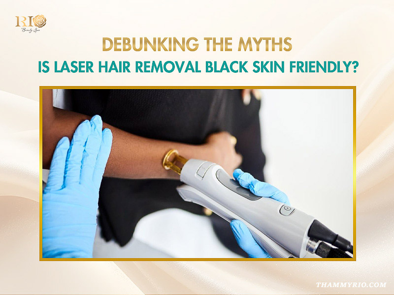 Professional laser hair removal for dark skin arm treatment at Rio Beauty Clinic.