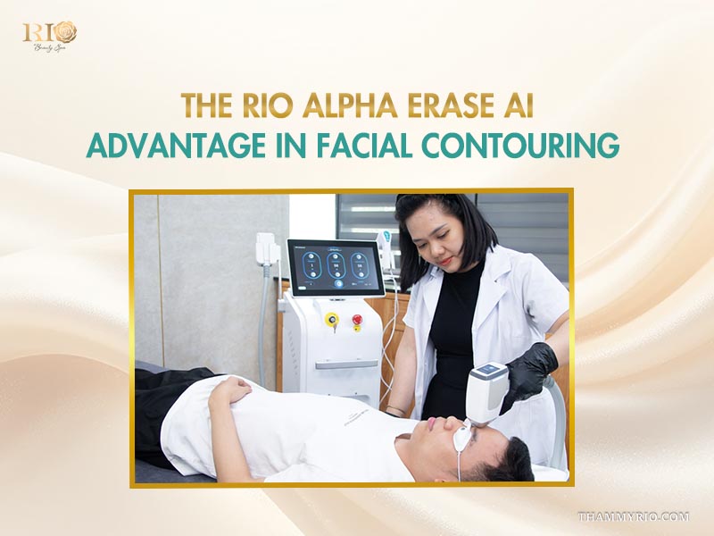 Hairline laser hair removal and facial contouring treatment with Rio Alpha Erase AI at Rio Beauty Spa.