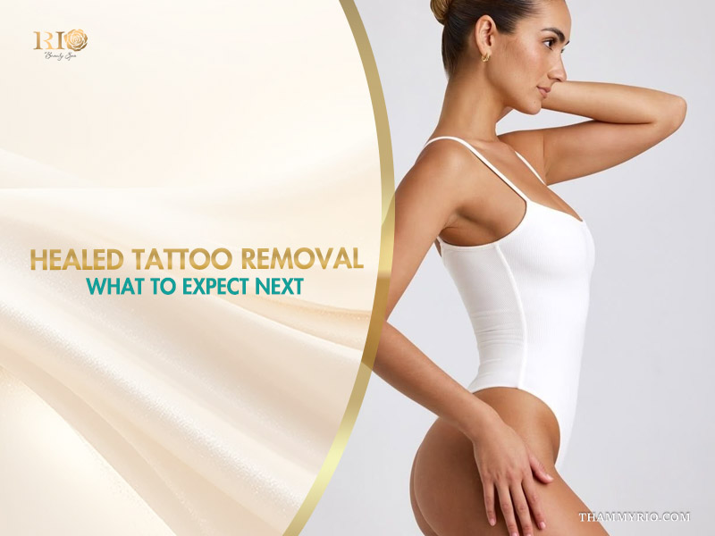 A woman standing confidently, representing the smooth skin results achieved after healed tattoo removal at Rio Beauty Clinic.