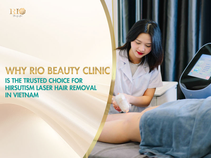 Professional hirsutism laser hair removal service performed by expert at Rio Beauty Clinic in Vietnam.