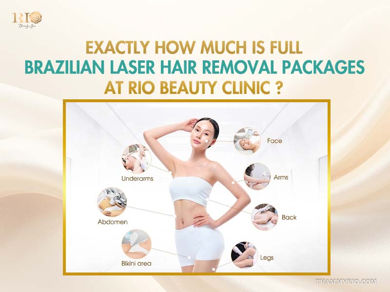 Body treatment areas map showing how much is full Brazilian laser hair removal package at Rio Beauty Clinic.