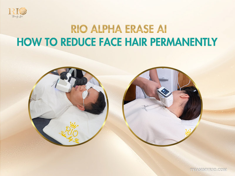 A person receiving laser treatment at a clinic for how to remove facial hair forever.