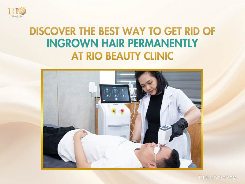 Expert providing effective ingrown hair removal treatment using advanced technology at Rio Beauty Clinic.